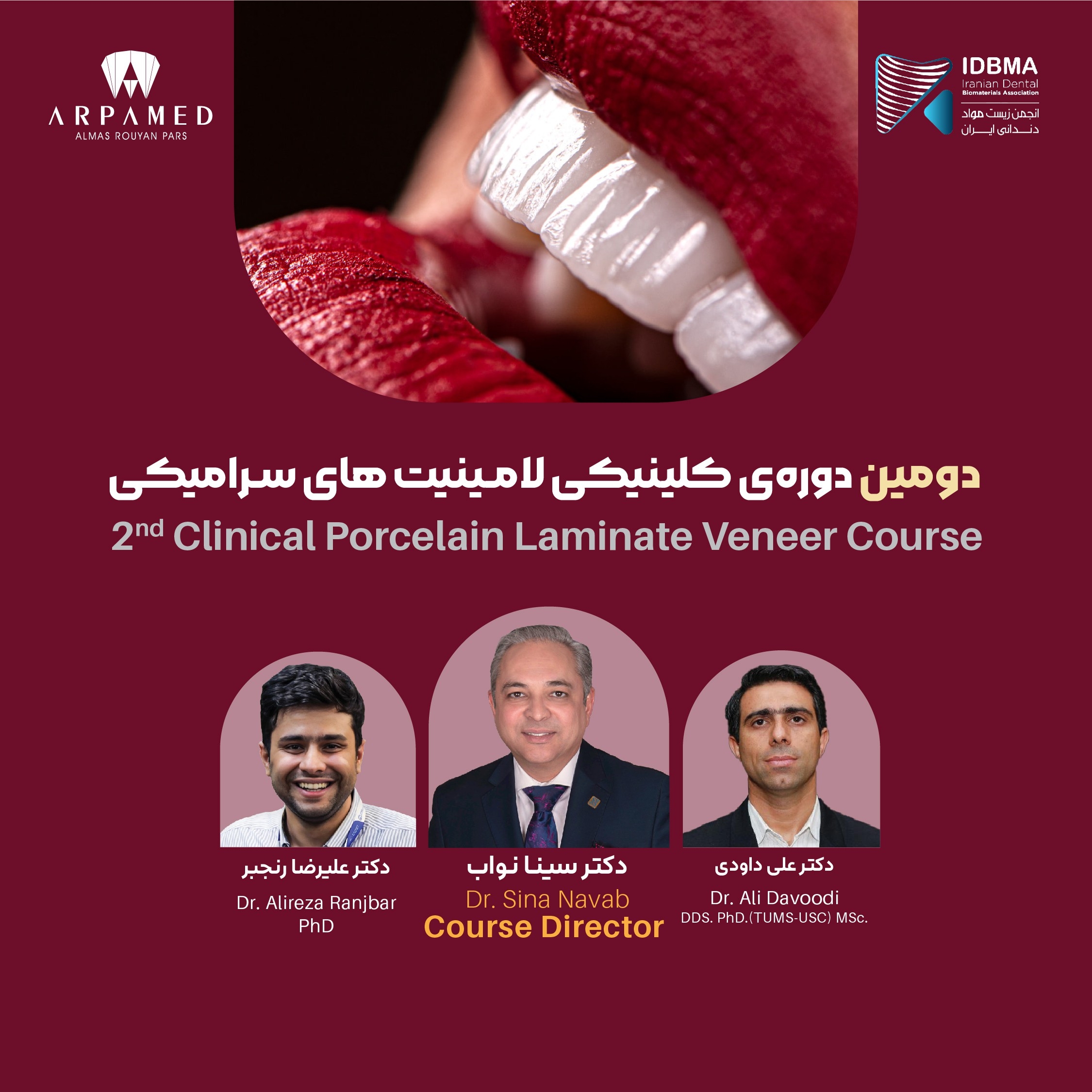 دومین دوره کلینیکی لامینیت های سرامیکی