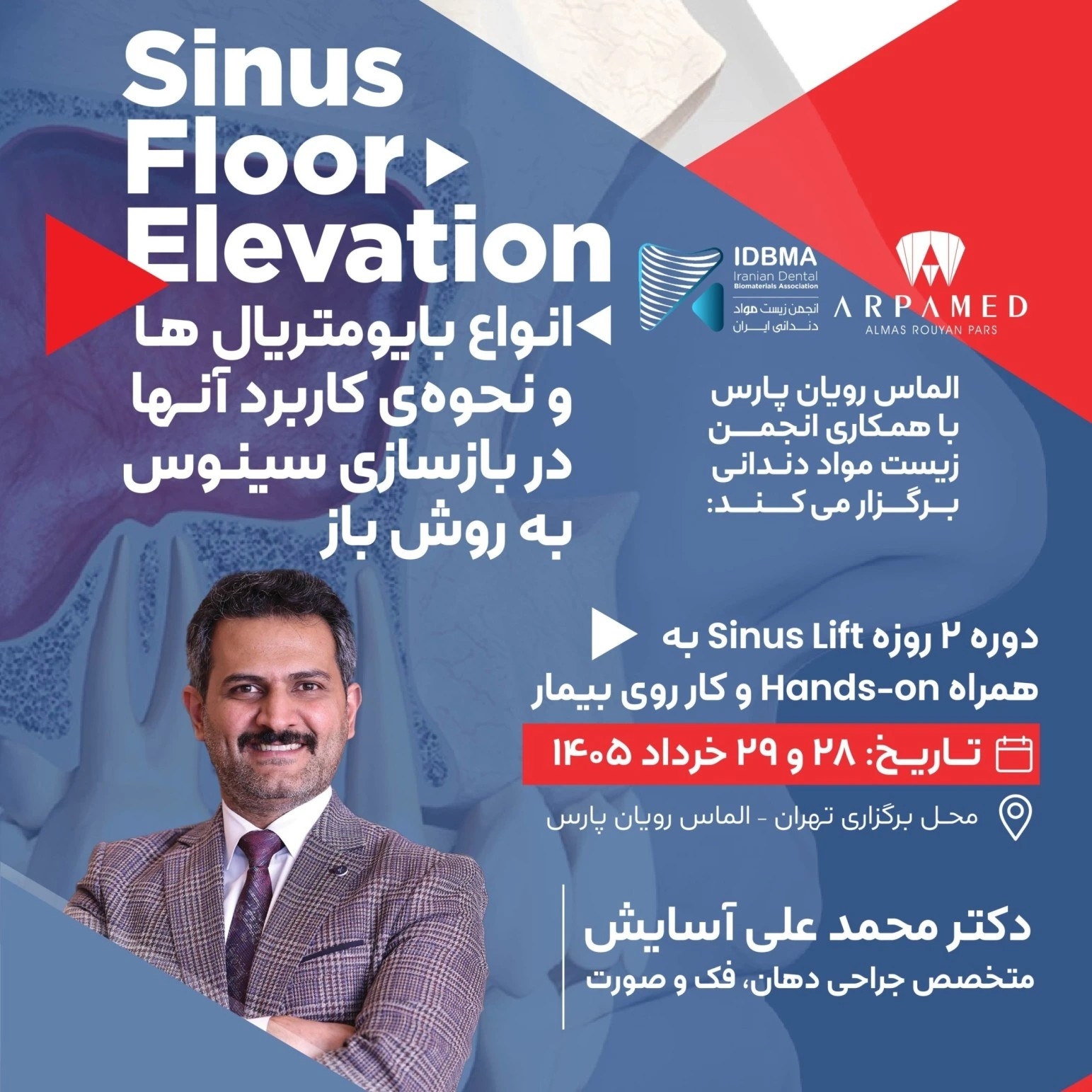 دوره آموزشی Sinus Floor Elevation 1405